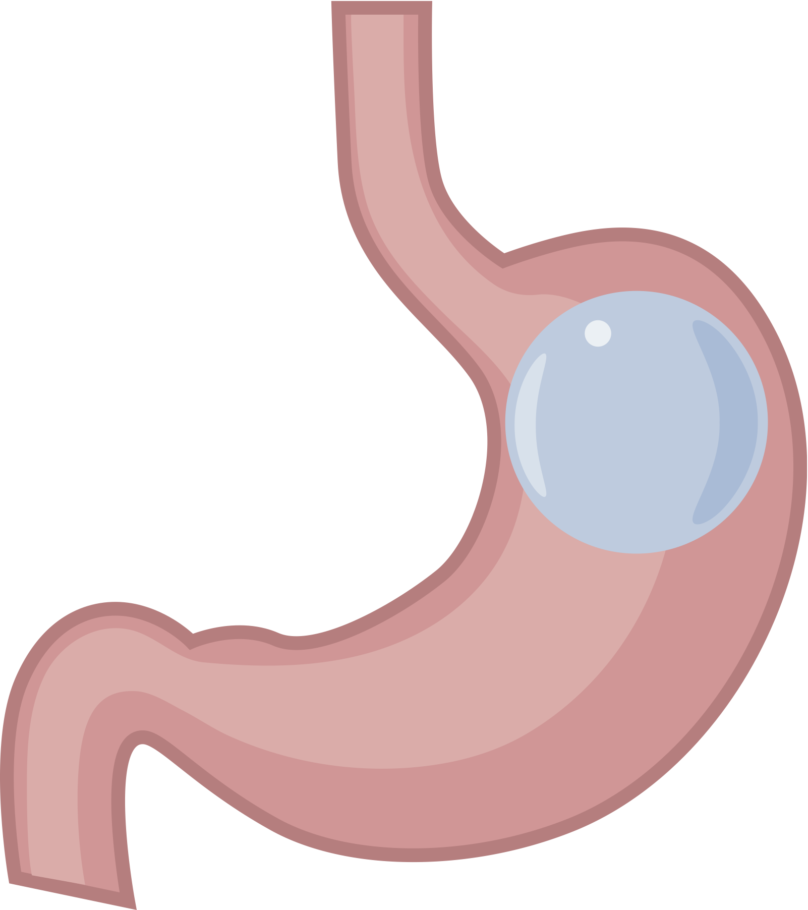 Gastric Balloon Surgery in Barrie